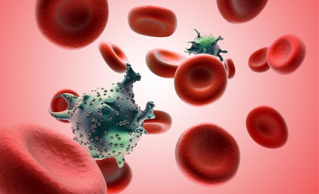 SENZACIONALNO OTKRIĆE Historičar otkrio kako je zapravo počela epidemija AIDS-a!
