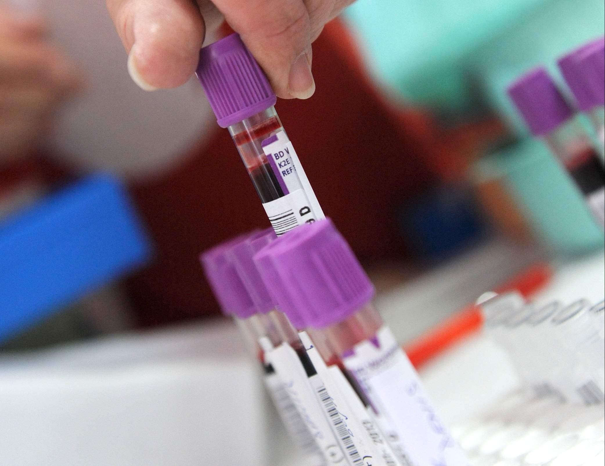 Nakon istraživanja: Leukemija s godinama neizbježna