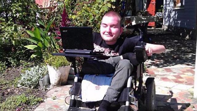 Upoznajte čovjeka koji će biti prvi pacijent podvrgnut transplantaciji glave