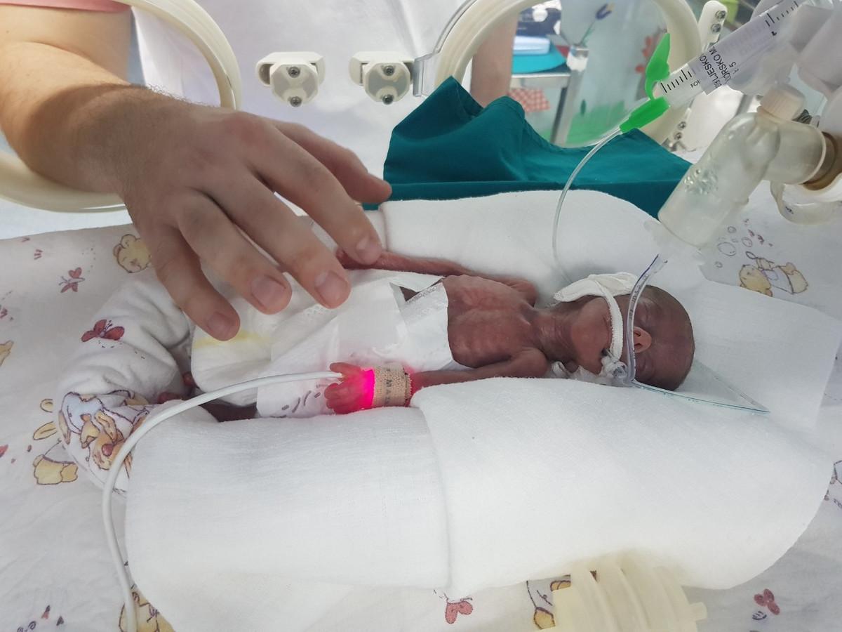 Rođena je sa 350 grama, a danas je zdrava beba