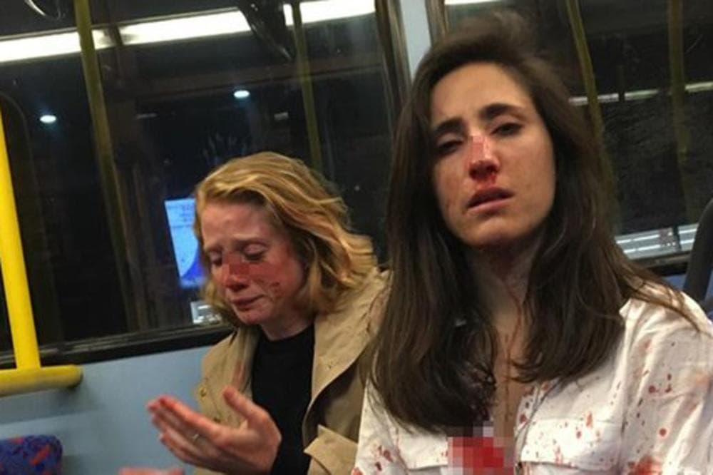 Brutalno pretukli dvije djevojke u autobusu jer nisu htjele ispuniti njihovu fantaziju