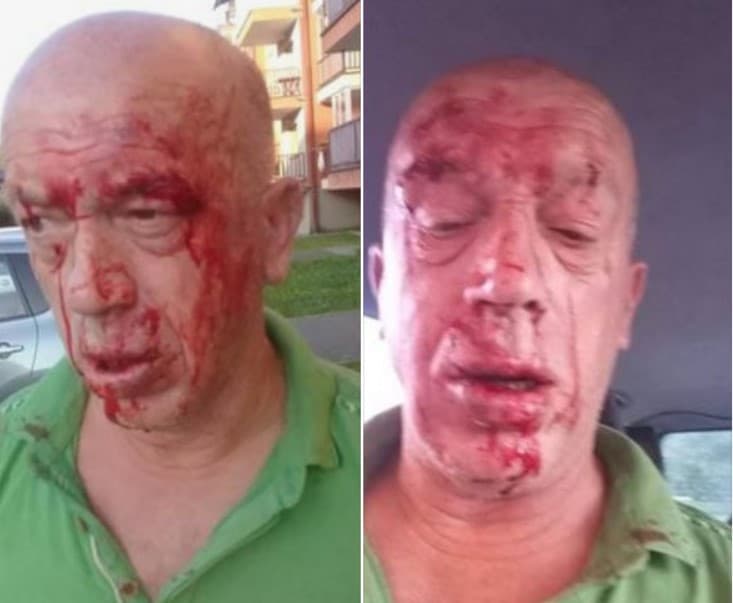 Aktivista SDS-a brutalno pretučen pred očima maloljetnog sina