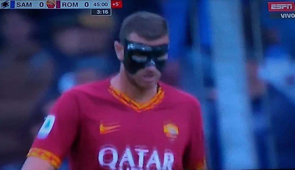 Ekspresan povratak na teren: Džeko zaigrao sa zaštitnom maskom