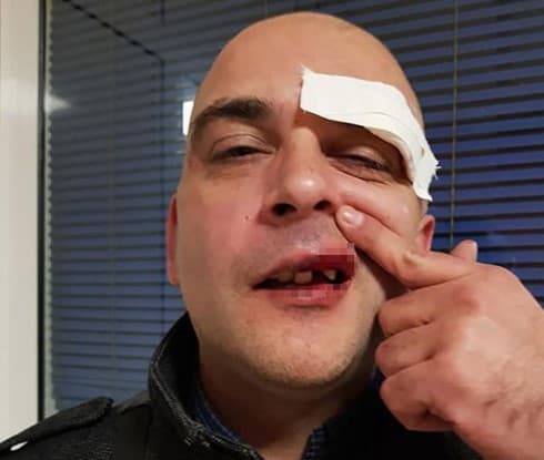 Ljubičasta torbica umalo mu došla glave: Brutalno pretučen jer su mislili da je gej