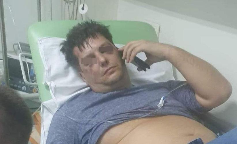 Biznismen iz Njujorka tvrdi da su ga pretukli policajci: Uspaničili se jer su mislili da sam umro pa mi podmetnuli brašno