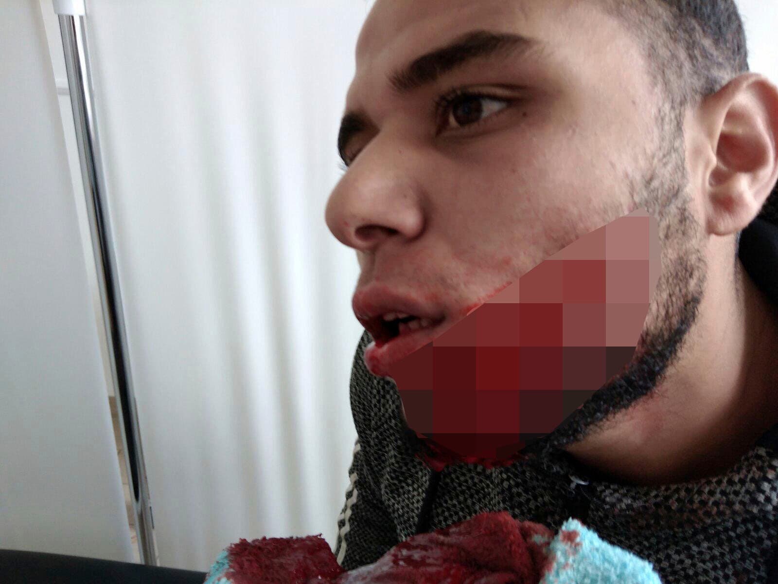 Uznemirujući sadržaj: Migrant brutalno porezan nožem u tučnjavi u tržnom centru