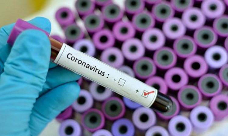 U Crnoj Gori 488 novih slučajeva covida, dvije osobe preminule