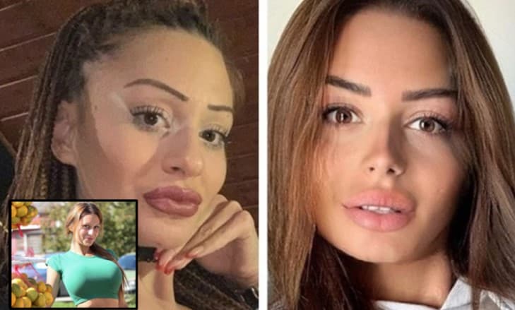 Svi se pitaju je li to ista osoba: Kristina Mandarina prije i poslije estetskih zahvata
