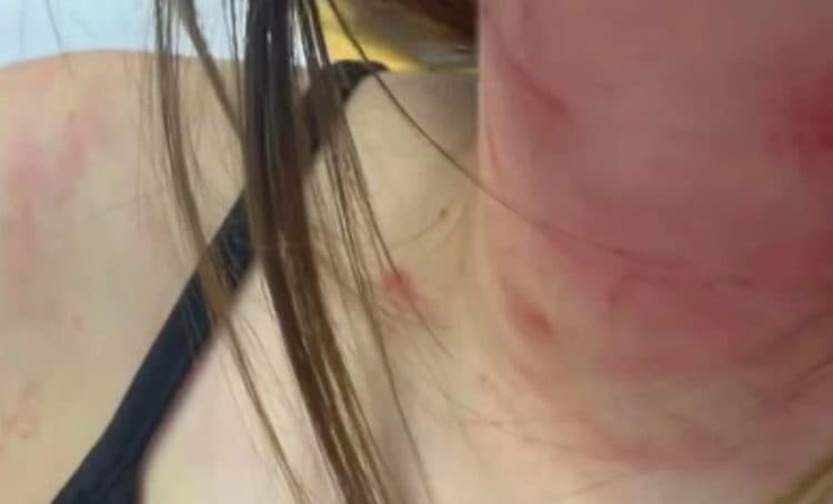 Uki Q nakon što joj je sestra pretučena: Objavila jezive detalje napada