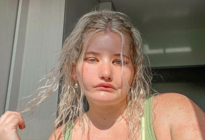 Djevojka koja se nikada nije mogla nasmijati postala model i inspiracija mnogima