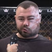Takmičar ostao unakaženog lica nakon borbe šamarima