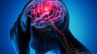 Naučnici razvili novu metodu kojom se smanjuje rizik od moždanog udara