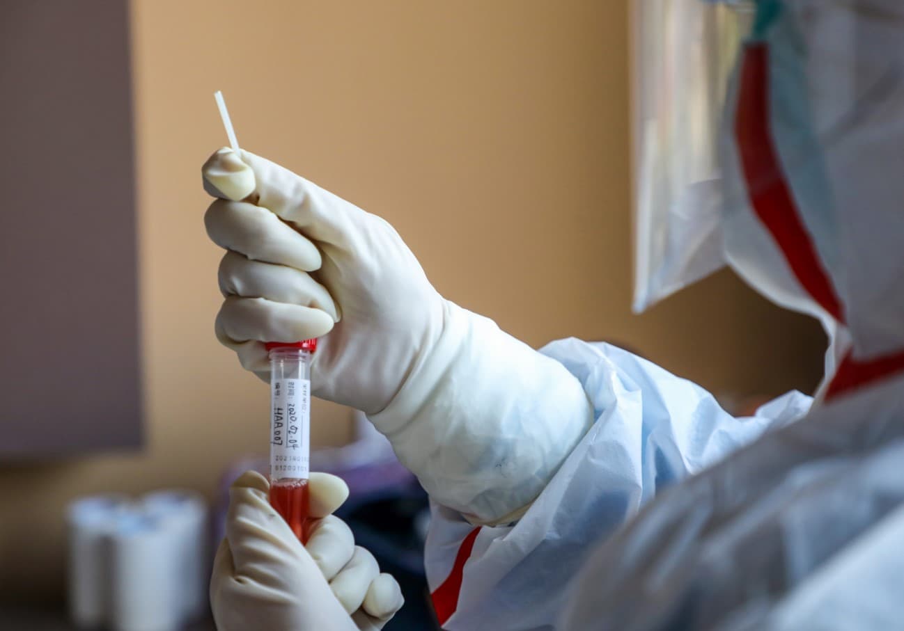 Druga žrtva koronavirusa u Francuskoj - Avaz