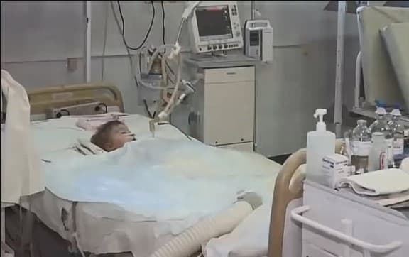 Dječak imao izuzetno teške povrede - Avaz