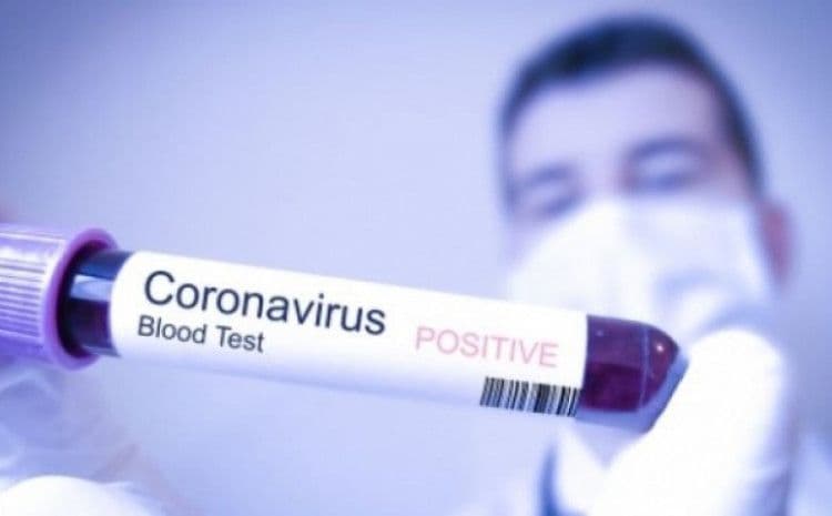 Koronavirus u KS - Avaz